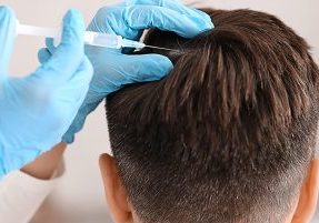 blog-hairtransplant